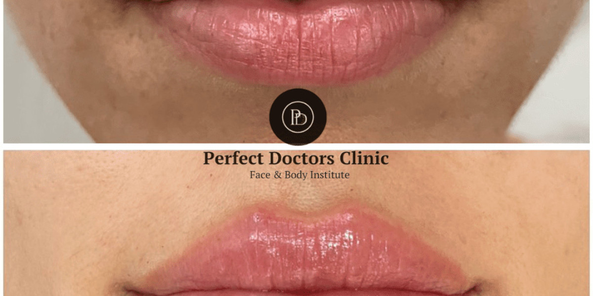 The Healing Process After Dermal Fillers: What to Expect from the Best Plastic Surgeons in Dubai