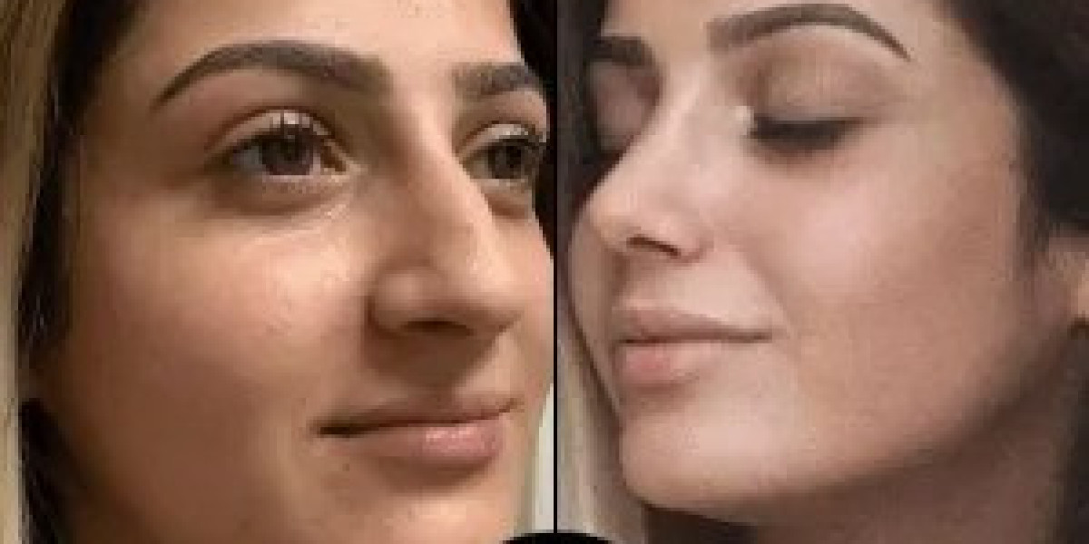 Best Aesthetic Clinics in Dubai with Personalized Care Plans