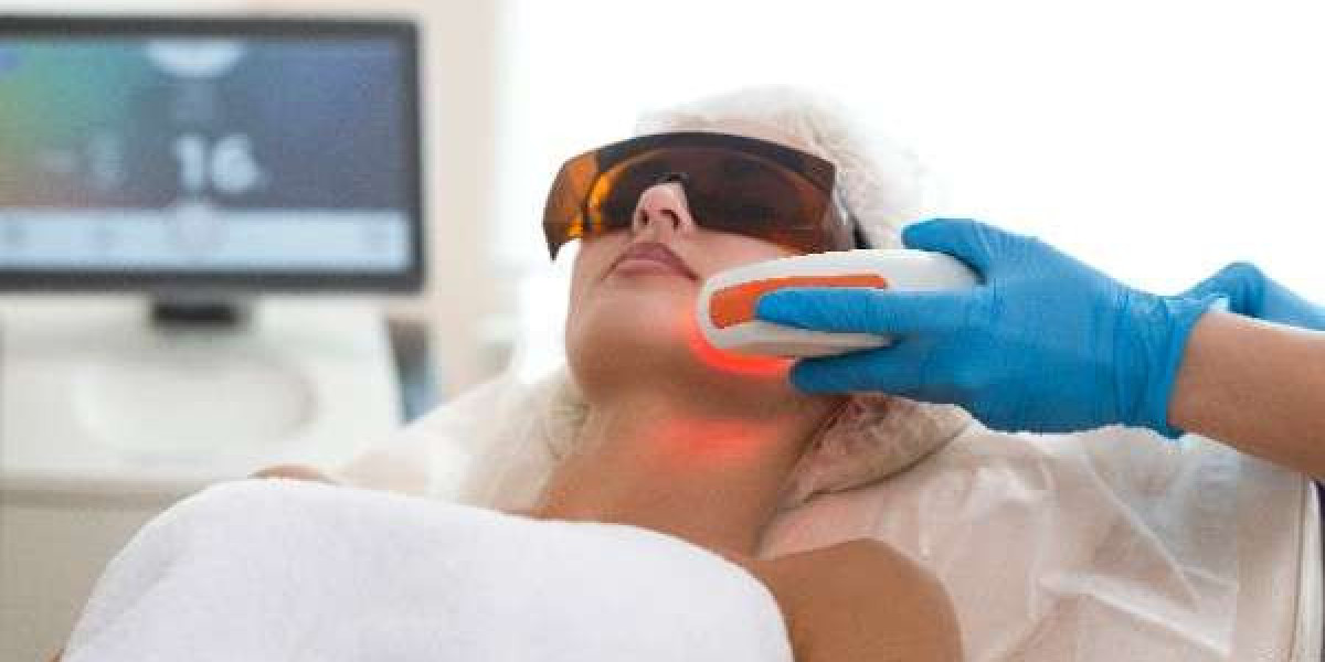 Unwanted Hair Gone, Thanks to Precise Laser Treatment