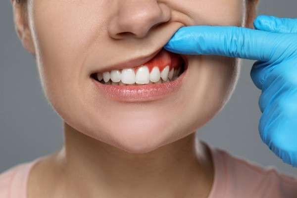 emergency dentist in Lincoln