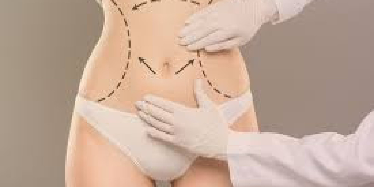 Best Tummy Tuck Surgeon in Dubai: Patient Success Stories