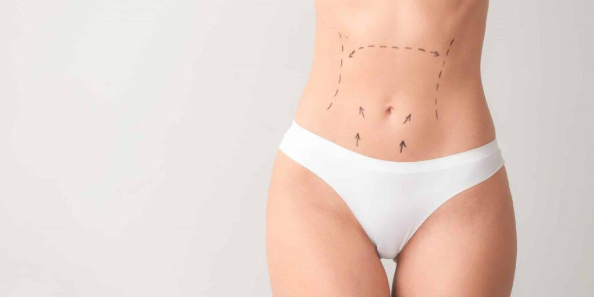 Mini Tummy Tuck Dubai: Before and After Results You Should Know
