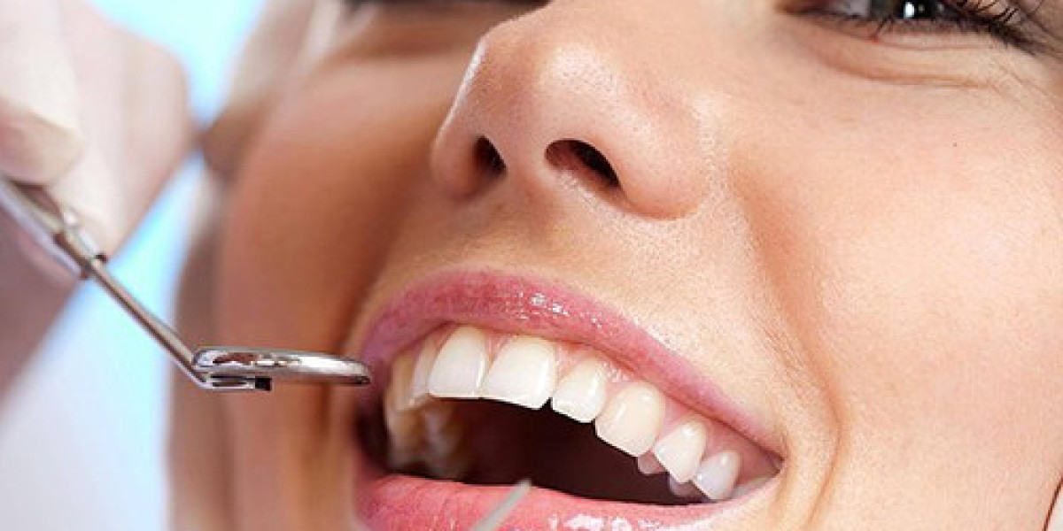 Dental Implants in Tampa: A Comprehensive Guide